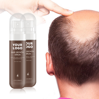 100% tinh khiết thực vật chiết xuất công thức da đầu huyết thanh dưỡng ẩm cho da đầu mạnh mẽ và khỏe mạnh