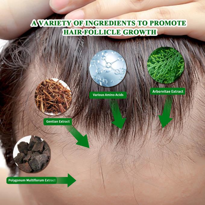Organic Hair Growth Serum Sử dụng bên ngoài Điều trị tái phát tóc chống rụng tóc Spray 80ml 0