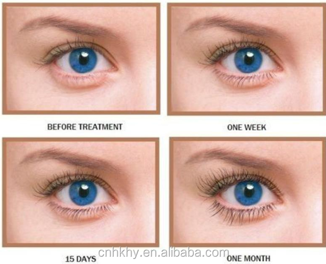 Trải nghiệm lông mi dài hơn với Bio-enzyme Lông mi phát triển huyết thanh Thời hạn sử dụng 3 năm 1