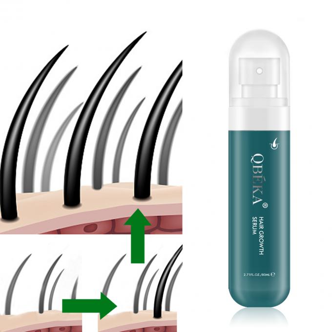 80ml dầu tăng trưởng tóc nhãn riêng sản phẩm chuyên nghiệp QC Team chống rụng tóc huyết thanh 0
