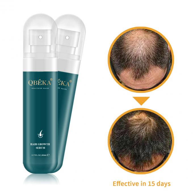 80ml dầu tăng trưởng tóc nhãn riêng sản phẩm chuyên nghiệp QC Team chống rụng tóc huyết thanh 1