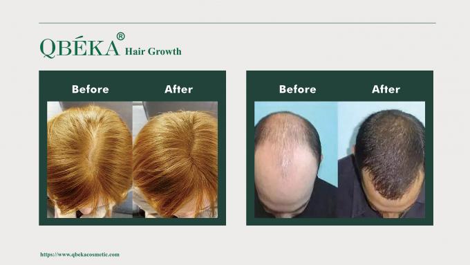 GMPC Shampoo tiêu chuẩn phòng ngừa rụng tóc để điều trị rụng tóc và mỏng tóc 80m 10