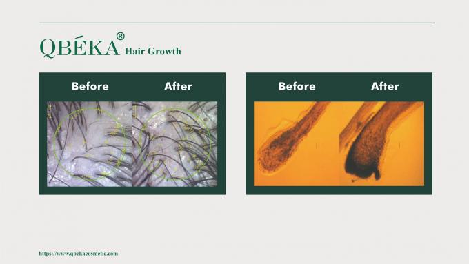 GMPC Shampoo tiêu chuẩn phòng ngừa rụng tóc để điều trị rụng tóc và mỏng tóc 80m 11