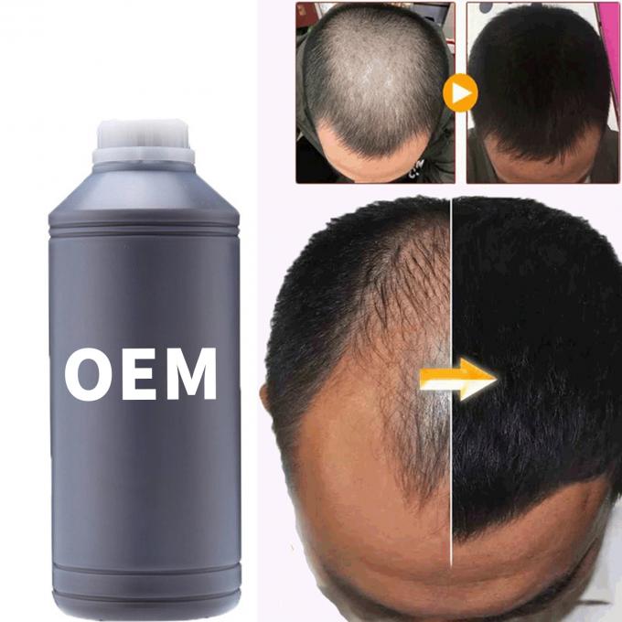 36 tháng Thời hạn sử dụng Sơ dầu tăng trưởng tóc cho tất cả các loại tóc 3