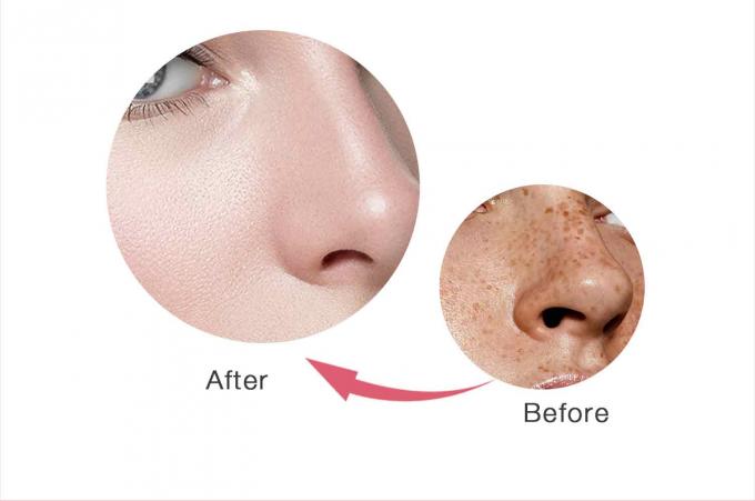 Kem mặt loại bỏ rách dựa trên glycerin cho sản phẩm chăm sóc da OEM / ODM nhãn riêng 9