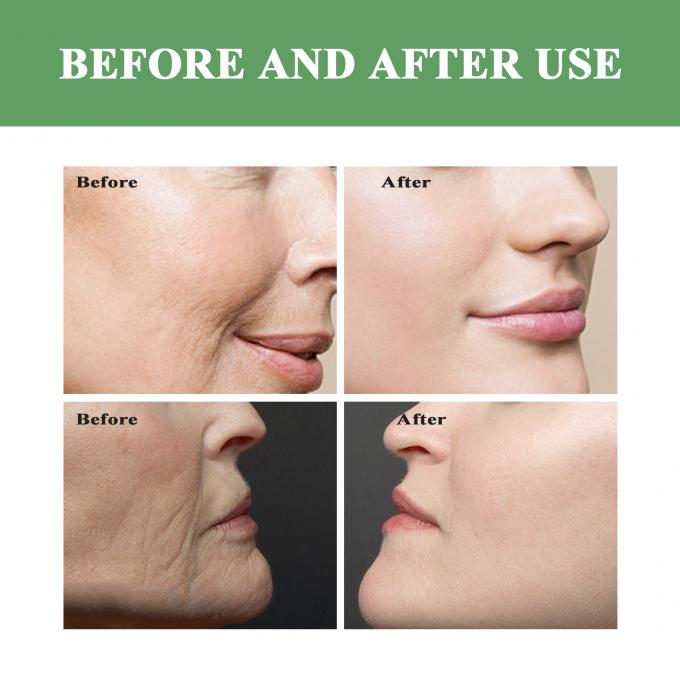 Organic Vitamin C Toner cho da nhạy cảm khô 100ml Nước hoa tùy chỉnh được chấp nhận 7