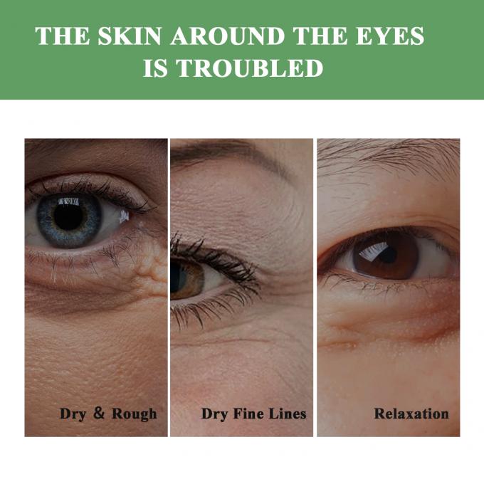 OEM Tăng sức sống Eye Cream vũ khí bí mật của bạn chống lại tuổi già mắt và vòng tròn đen 8