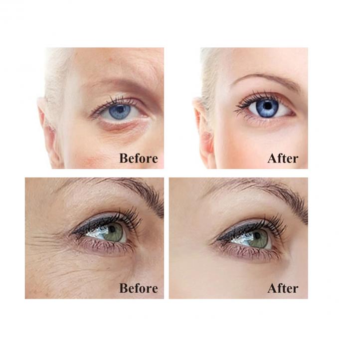 OEM Tăng sức sống Eye Cream vũ khí bí mật của bạn chống lại tuổi già mắt và vòng tròn đen 9