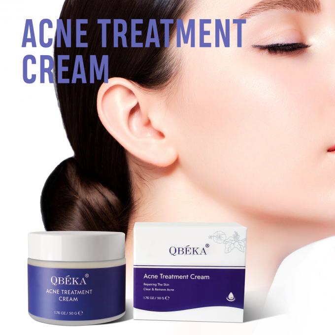 Kem trị mụn trà xanh hiệu quả cho phụ nữ 0