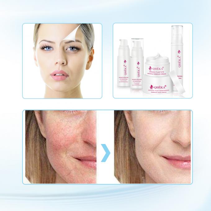 Fade Hyperpigmentation ẩm và làm sáng mặt kem với thời hạn sử dụng 3 năm 2
