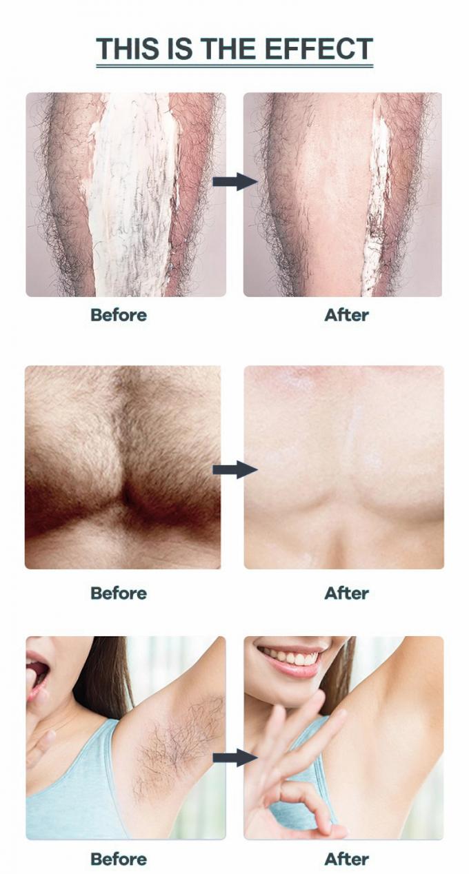 Loại bỏ tóc nhẹ nhàng cho các bộ phận riêng tư Ách chân và cánh tay Không kích thích hoặc đỏ 10