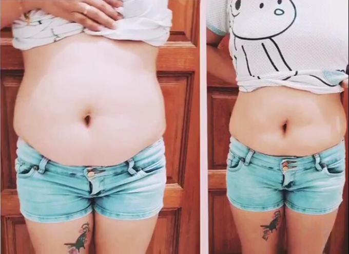 Legs and Hand Slimming Cream 100000pcs Fat Removing Cream for Women Breast Reduction (Thiện giảm béo cho phụ nữ) 3