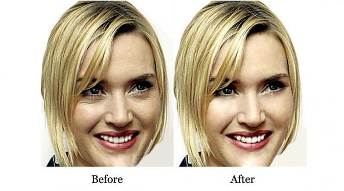 Ưu điểm của QBEKA Protein Peptide Serum giữ nước và sửa chữa sẹo mụn 10ml 7