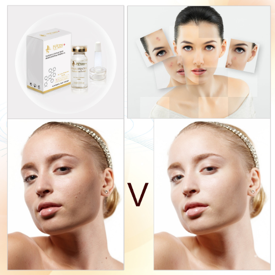 Kích thước thông thường Vitamin C hữu cơ làm sạch làm trắng chống freckles Ampoules Số lượng 1000 1